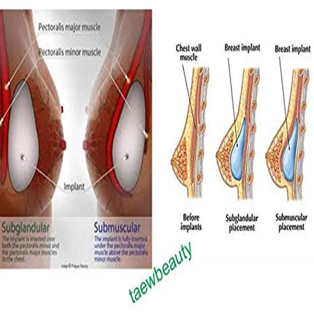 Ivymaison Bella Cream Breast Enhancement In Pakistan